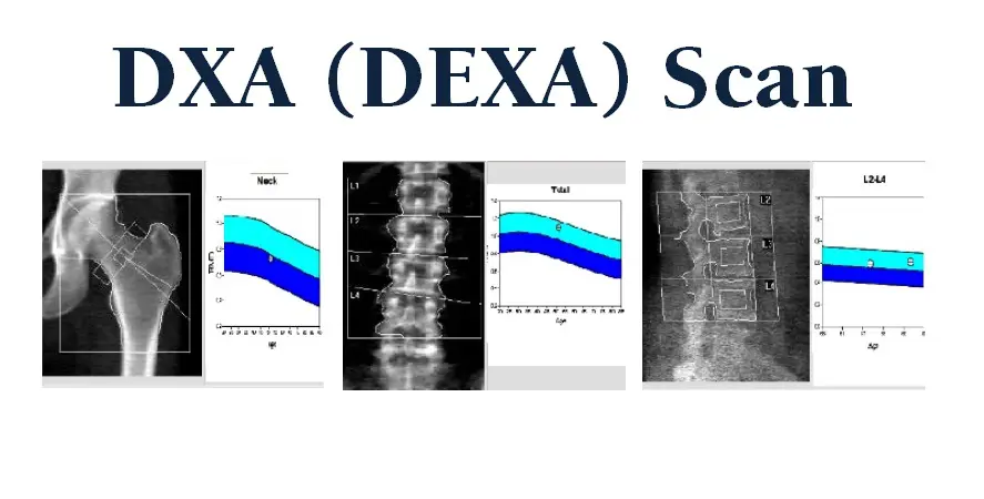 A series of images showing the effects of dexa scan.